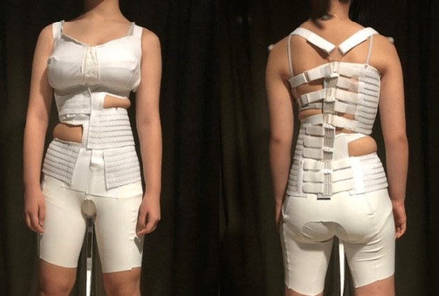 Preliminary wear trial of anisotropic textile brace designed for adolescent idiopathic scoliosis